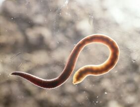 human parasitic worms