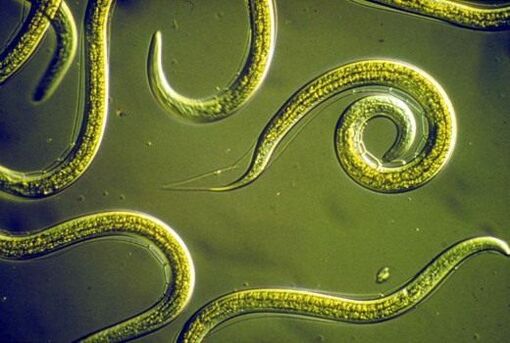 Nematode worms are parasitic in the human small intestine